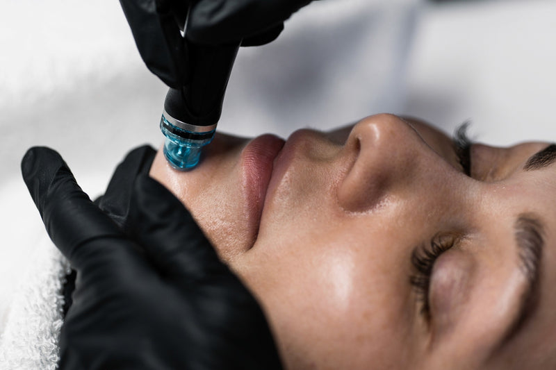 2. Hydrafacial treatment