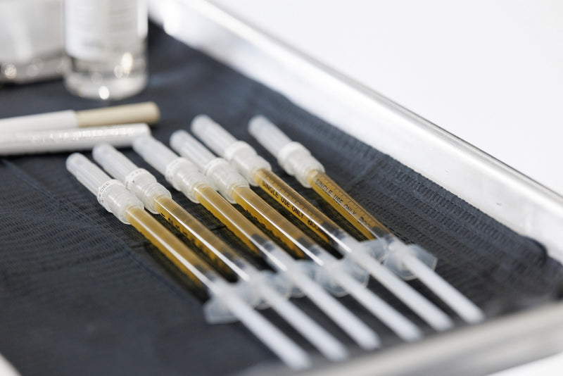 2. Séance de traitement